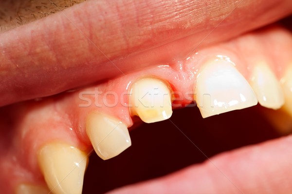 Dentist 's work Stock photo © Lighthunter