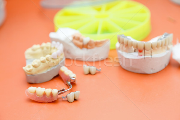 Protézis fogorvosok iroda véletlenszerű fogászati termékek Stock fotó © Lighthunter