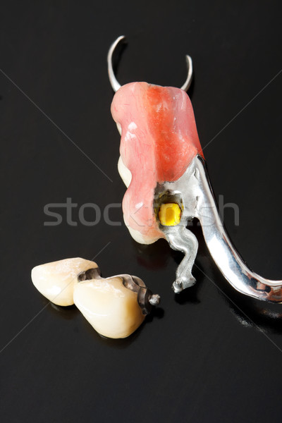 Substituição dentes prótese desaparecido especial lata Foto stock © Lighthunter