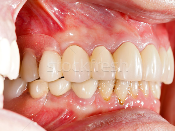 Stok fotoğraf: Diş · insan · ağız · sağlık · tıp · dişler