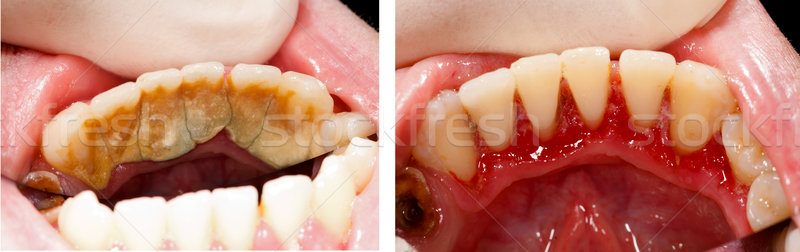 Tedavi tanımlama ofis ağız dişler Stok fotoğraf © Lighthunter