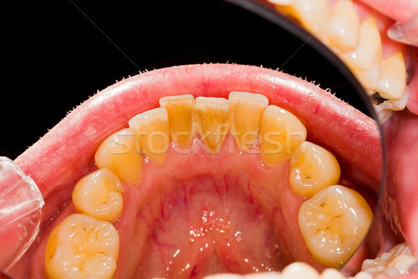 Foto stock: Remoção · humanismo · dentistas · escritório · trabalhar