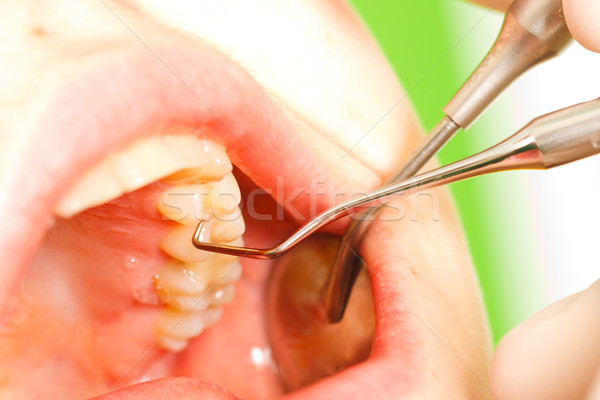 Dental Examination Stock photo © Lighthunter