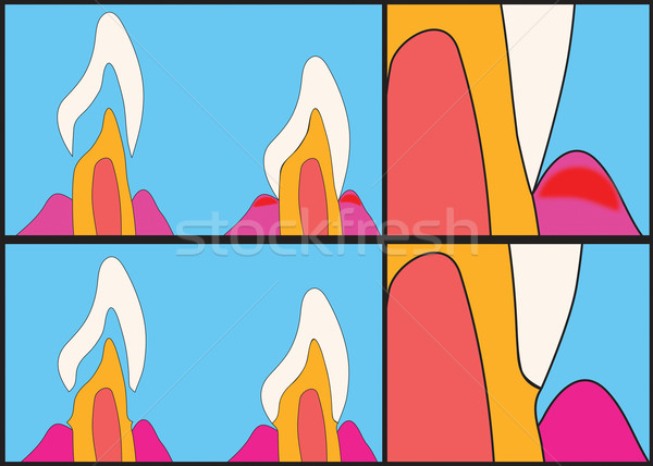 Buffing Teeth Tangent or Shoulder Way. Stock photo © Lighthunter