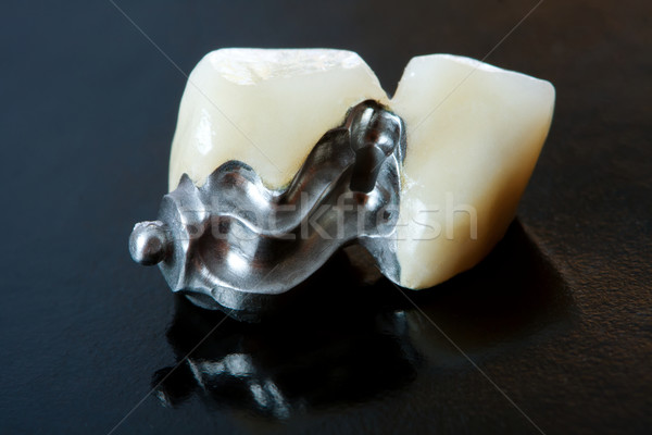 Fix protézis hiányzó fogak különleges konzerv Stock fotó © Lighthunter