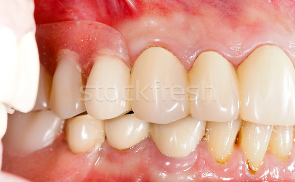 Stok fotoğraf: Diş · insan · ağız · sağlık · tıp · dişler