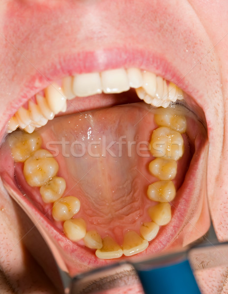 Dental photograpy Stock photo © Lighthunter