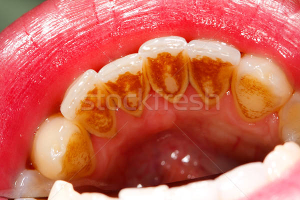 Stockfoto: Tandheelkundige · gevolg · voedsel · roken · koffie