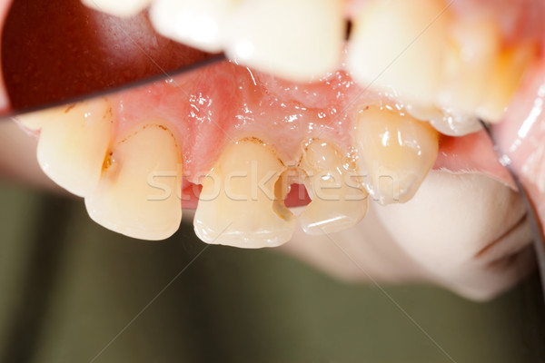 Höhle selten Winkel Zähne müssen zahnärztliche Stock foto © Lighthunter