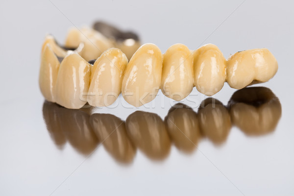 Ceramică dinţi dentar pod frumos Imagine de stoc © Lighthunter