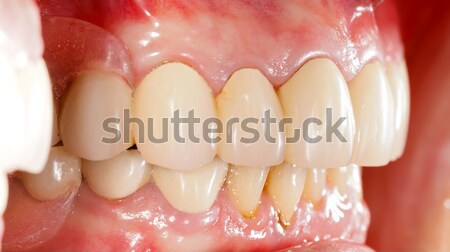 Zahnärztliche Füllung Behandlung Zahn Büro medizinischen Stock foto © Lighthunter