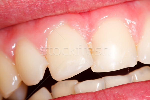 Teeth Stock photo © Lighthunter