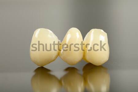Keramische kroon gezondheid tanden zorg Stockfoto © Lighthunter