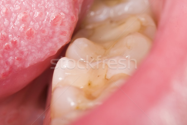 A close-up photo of a tongue and molar teeth. Stock photo © Lighthunter