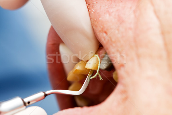 Zahnärztliche Schnur Zahnarzt Thread Garn Aufnahme Stock foto © Lighthunter