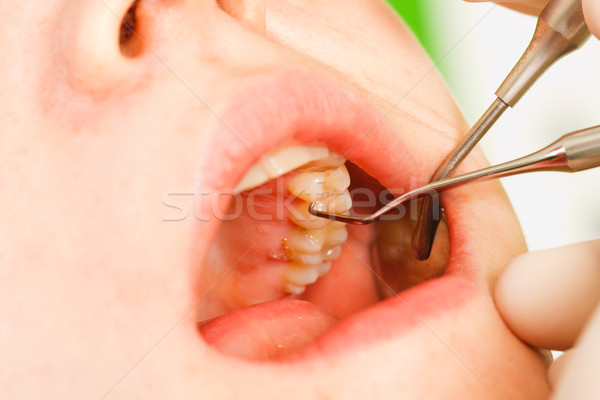 Dental medico giovani paziente speciale Foto d'archivio © Lighthunter