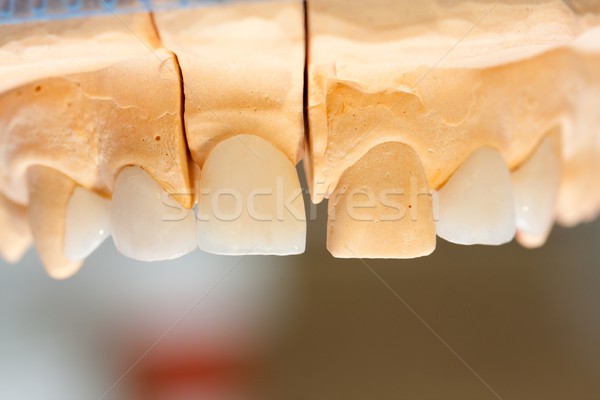 Dişçi çalışmak dünya seramik alçıtaşı Stok fotoğraf © Lighthunter