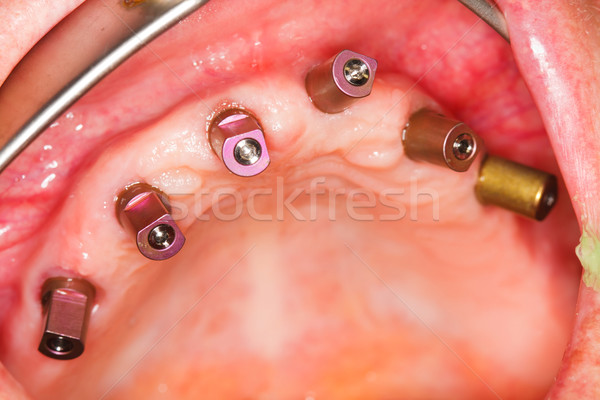 Macro tiro dentales oral cavidad humanos Foto stock © Lighthunter