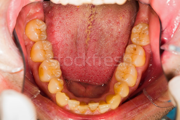 Senken natürlichen Patienten Zahnärzte Büro medizinischen Stock foto © Lighthunter