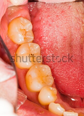 Dentist 's work Stock photo © Lighthunter