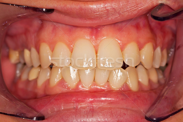 Emberi fogak kilátás puha kettő fókusz Stock fotó © Lighthunter