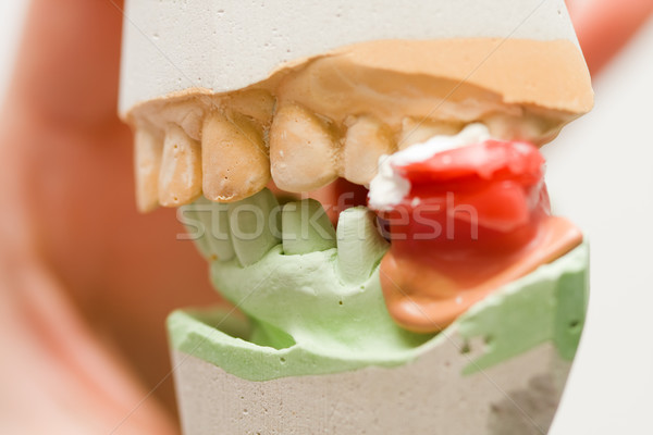 Mordere registrazione dentista tecnico riabilitazione Foto d'archivio © Lighthunter
