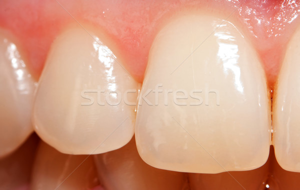 Egészséges fogak fotó száj fog beteg Stock fotó © Lighthunter