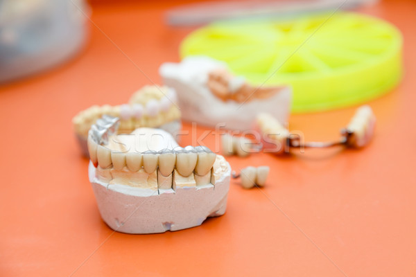 Metalo-acrylic teeth Stock photo © Lighthunter