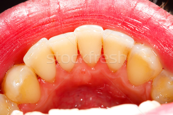 Stockfoto: Menselijke · tanden · gezondheid · geneeskunde · tand · tandheelkundige