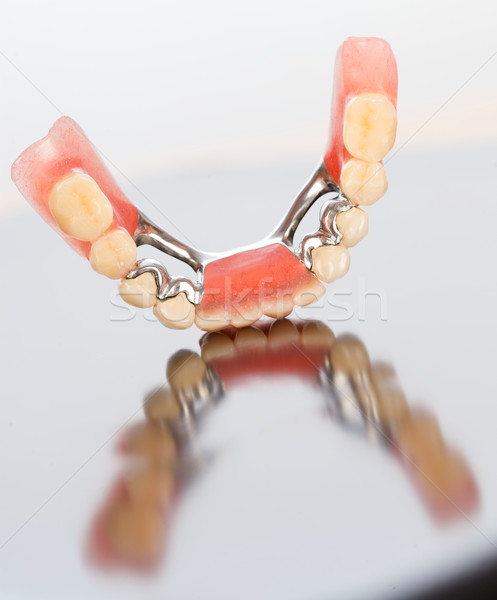 Foto stock: Baixar · prótese · dental · cerâmico · saúde