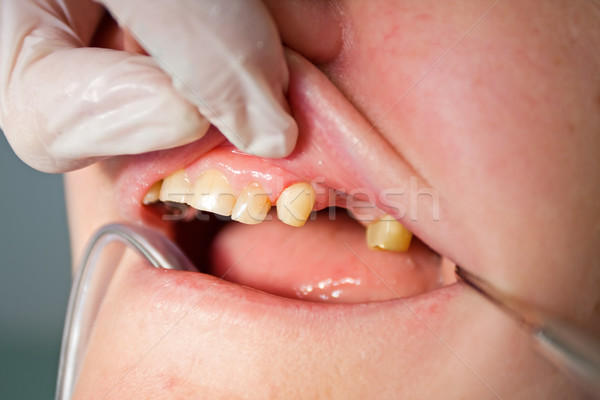 At the dentist Stock photo © Lighthunter