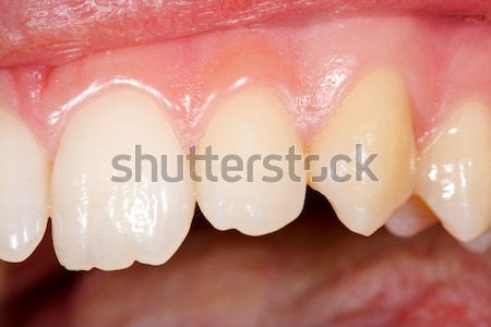 Healthy human teeth Stock photo © Lighthunter