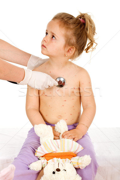 Little girl with small pox at the doctors Stock photo © lightkeeper