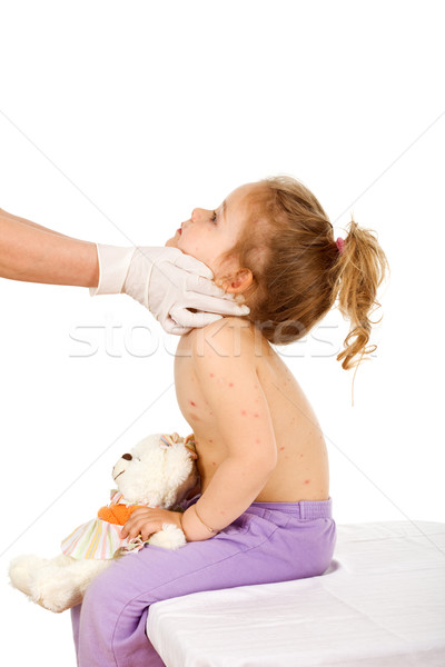 Stock photo: Doctor examining kid with small pox or skin rash