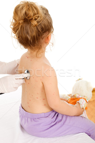 Physical exam of a pimpled kid Stock photo © lightkeeper