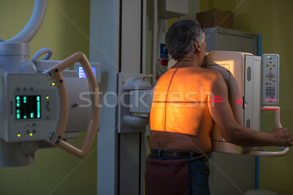 Foto stock: Altos · masculina · paciente · Xray · salud