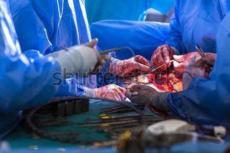 Surgery in a modern hospital being performed by a team Stock photo © lightpoet