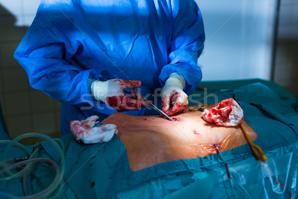 Surgeon performing an operation on a patient in a hospital  Stock photo © lightpoet