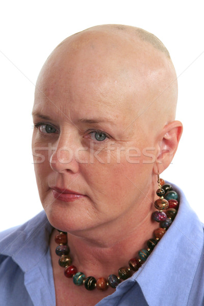 Moi cancer survivant regarder peur malheureux [[stock_photo]] © lisafx