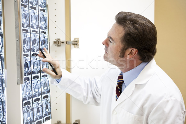 Chiropraticien scanner médecin résultats chat Photo stock © lisafx