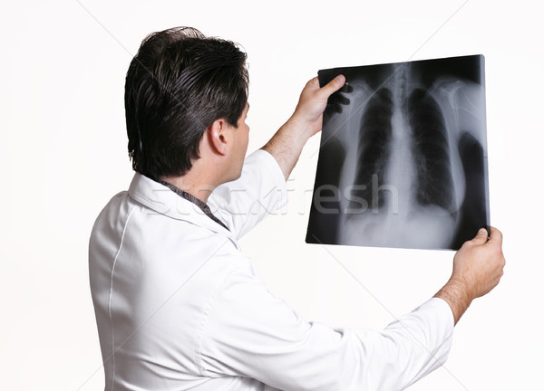 醫生 X射線 檢查 病人 男子 商業照片 © lovleah