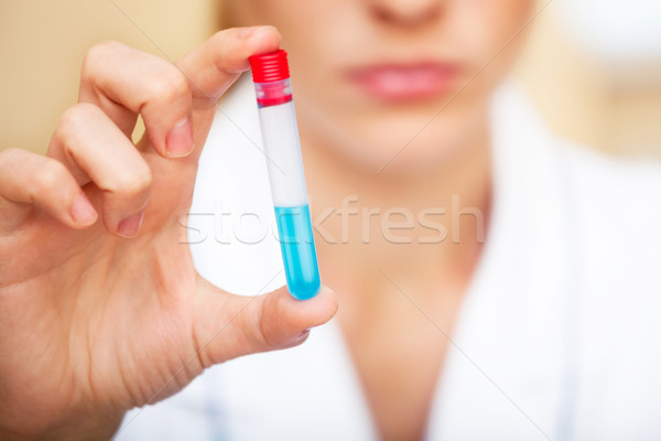Unhappy young scientist holding samples with bad testing results Stock photo © luckyraccoon