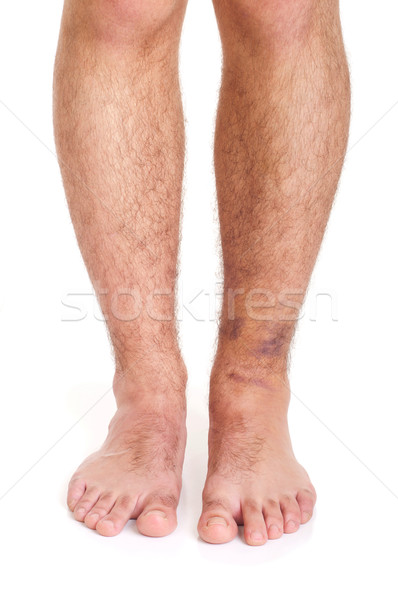 腳踝 扭傷 年輕 男 孤立 白 商業照片 © luissantos84