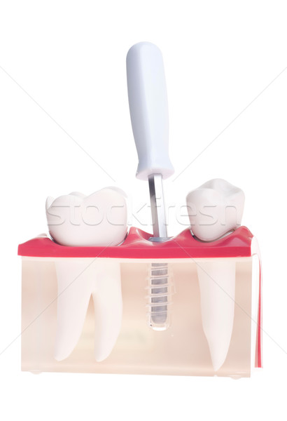 Implant dental model Stock photo © luissantos84