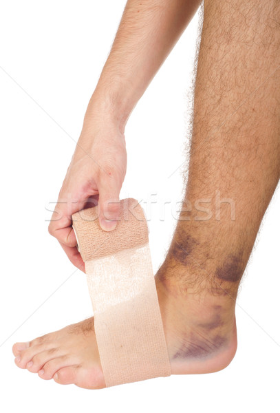 Stock photo: Bandaging a sprained ankle