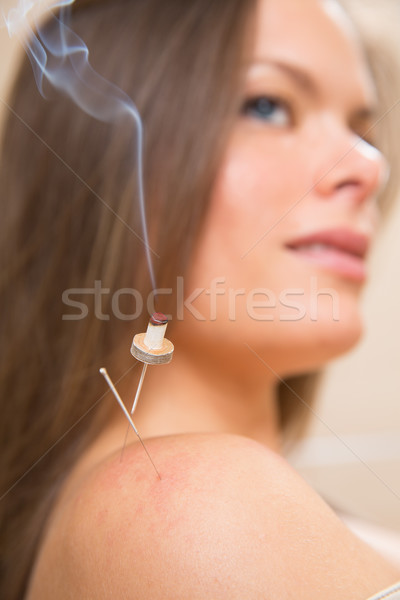 Stock photo: moxibustion acupunture needles heat on woman