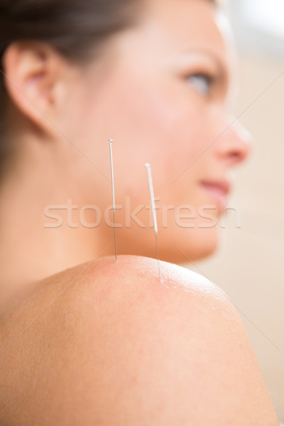 иглоукалывание иглы женщину плечо терапии Сток-фото © lunamarina