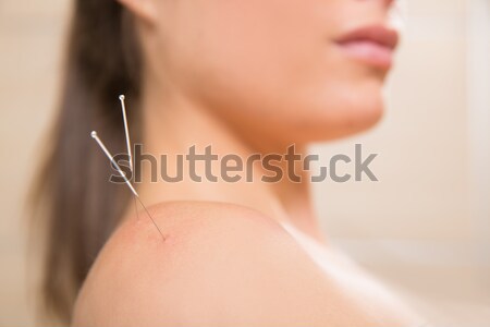 Acupuntura aguja mujer hombro terapia primer plano Foto stock © lunamarina