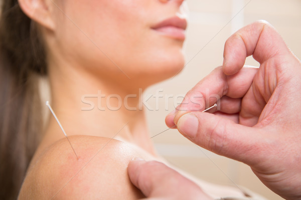 [[stock_photo]]: Médecin · mains · acupuncture · aiguille · femme · patient