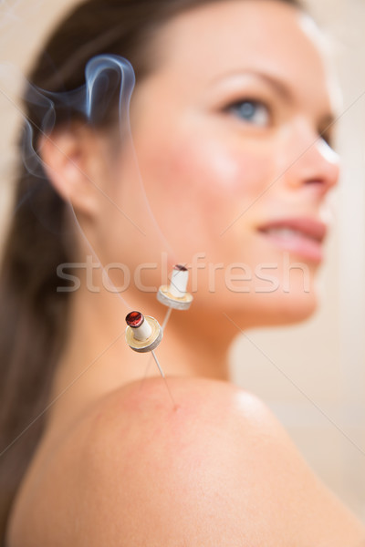 moxibustion acupunture needles heat on woman Stock photo © lunamarina